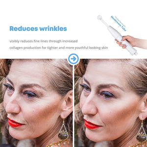 High-Frequency Skin Aesthetics Therapy Wand